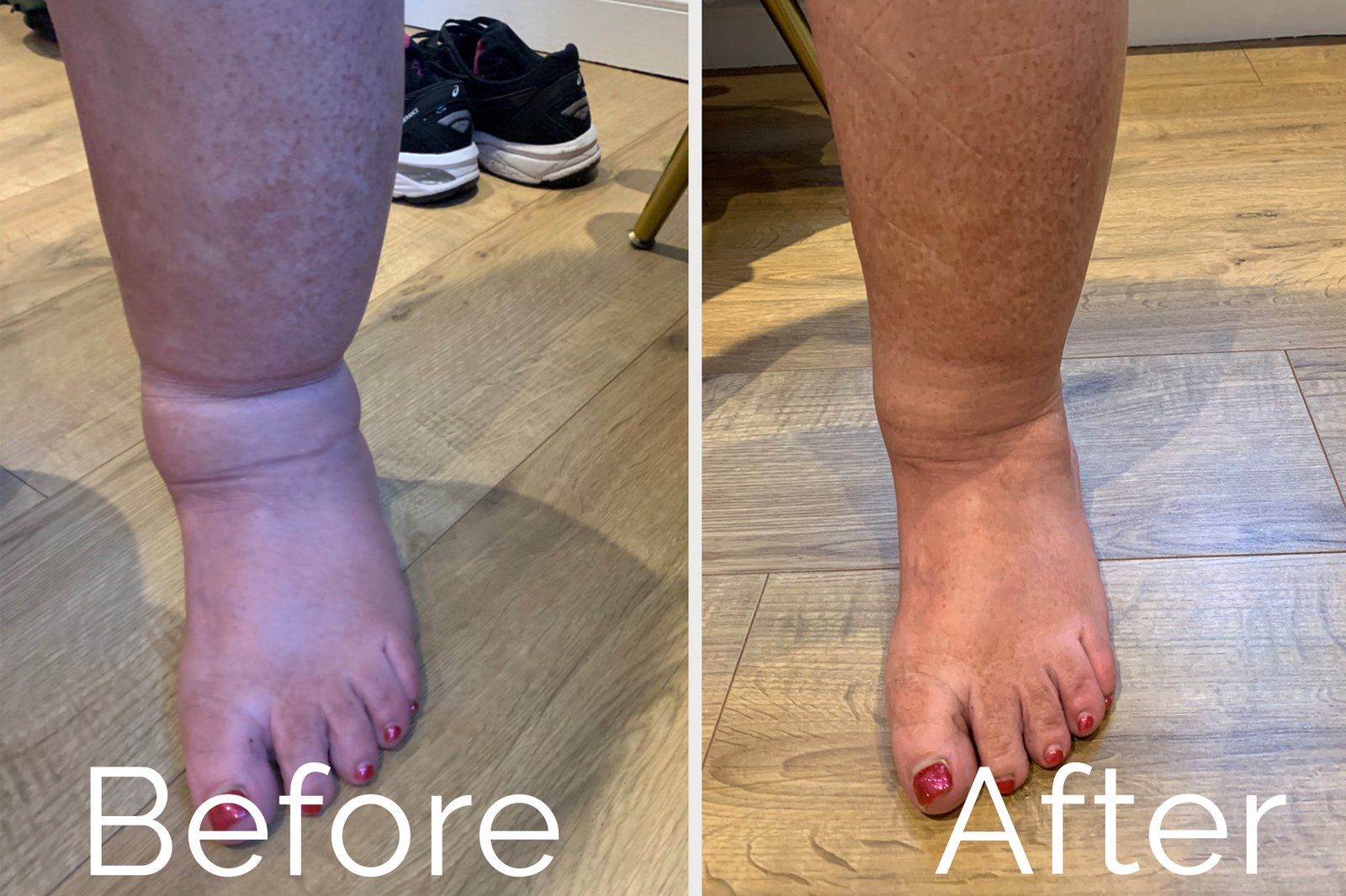 Life Mind Body - Treatments - Lymphatic Drainage Massage